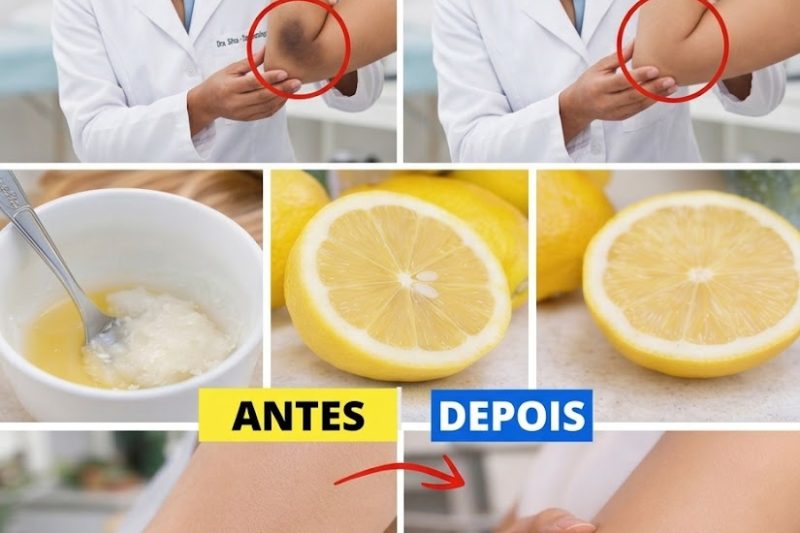 Axilas Escuras? Maneiras Naturais e Seguras de Clareá-las Suavemente em Casa