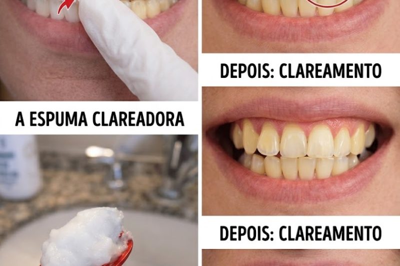 Clareie Seu Sorriso de Forma Natural: A Mistura de Alho e Bicarbonato que Pode Ajudar a Deixar os Dentes Mais Brancos em Minutos