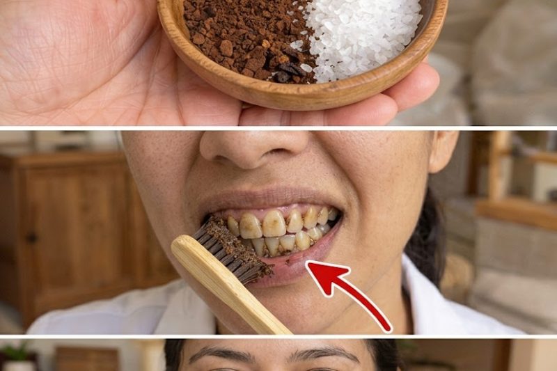 9 Maneiras Naturais e Suaves de Reduzir a Placa e o Tártaro (Sem Danificar o Esmalte Dentário)