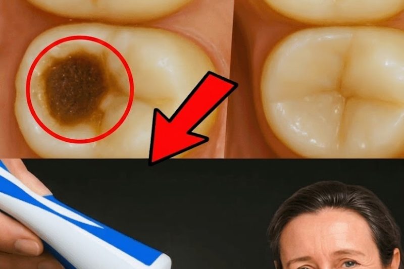 Pasta de Dente com Alho: Um Remédio Natural Surpreendente para Cuidar das Cáries e da Saúde Bucal