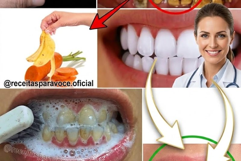11 Maneiras Naturais de Clarear os Dentes em Qualquer Idade (Sem Usar Produtos Químicos!)
