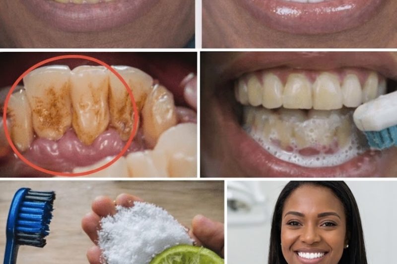 Dentes Mais Brancos em Poucos Dias: O Truque Natural Seguro que as Grandes Marcas Não Querem que Você Conheça