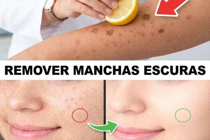 Desapareça com Manchas da Idade Naturalmente: Máscara Simples de Amido de Milho, Bicarbonato e Limão para uma Pele Mais Clara e Uniforme