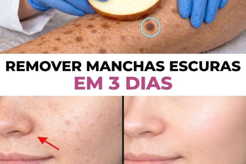 Elimine manchas da idade, melasma e sinais de envelhecimento naturalmente