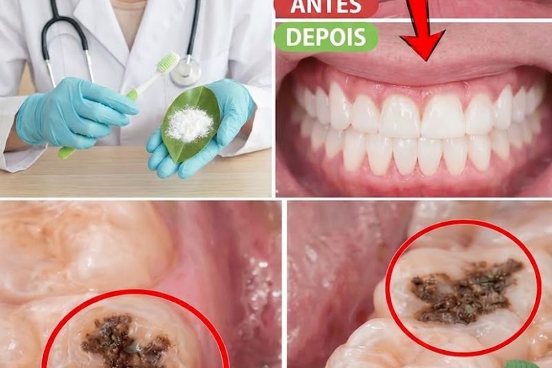 Folhas de Goiaba para a Saúde Bucal Um hábito tradicional diário que muitas pessoas com cáries consideram surpreendentemente útil