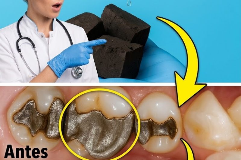 O Carvão Ativado e o Limão Podem Realmente Curar Cáries de Forma Natural?