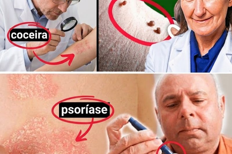 10 Sinais Alarmantes de Açúcar no Sangue Elevado Que Você Não Pode Ignorar