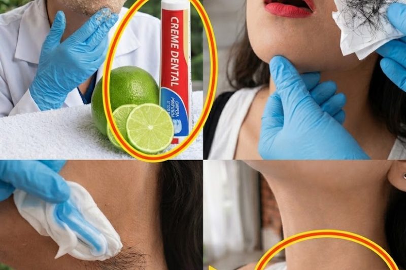 Como Explorar Maneiras Naturais de Lidar com Pelos Faciais Indesejados em Casa: Um Guia Suave