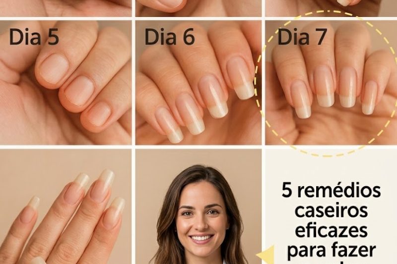 Revitalize Suas Unhas com o Segredo Natural do Alho