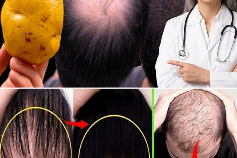 O Cabelo Cresce Como Louco e Não Cai! Esta é a Receita Mais Poderosa!