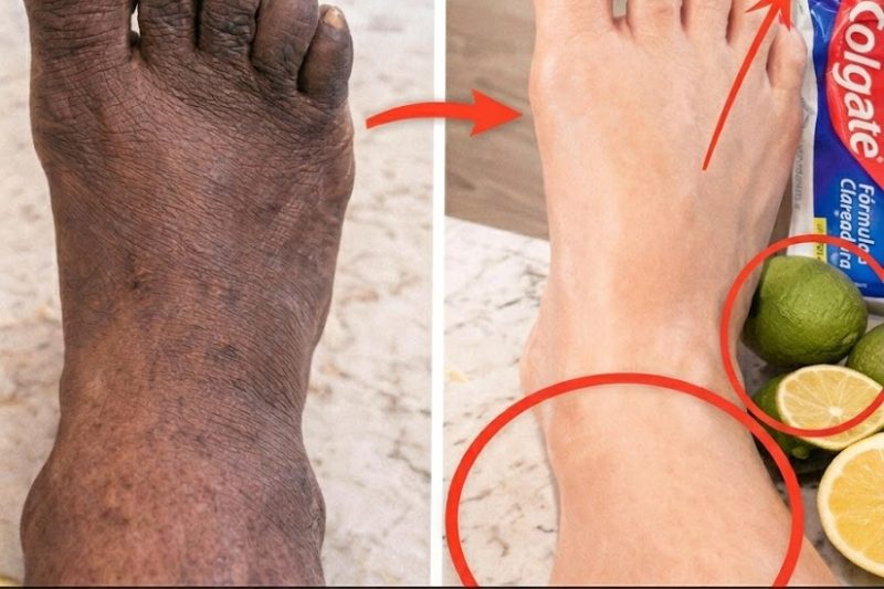 Como Transformei a Aparência das Minhas Pernas: Pele Mais Lisa, Iluminada e Saudável com Hábitos Simples