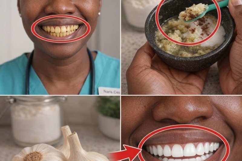 Uma Maneira Natural de Iluminar Seu Sorriso: O Truque Surpreendente com Alho que Você Nunca Tentou