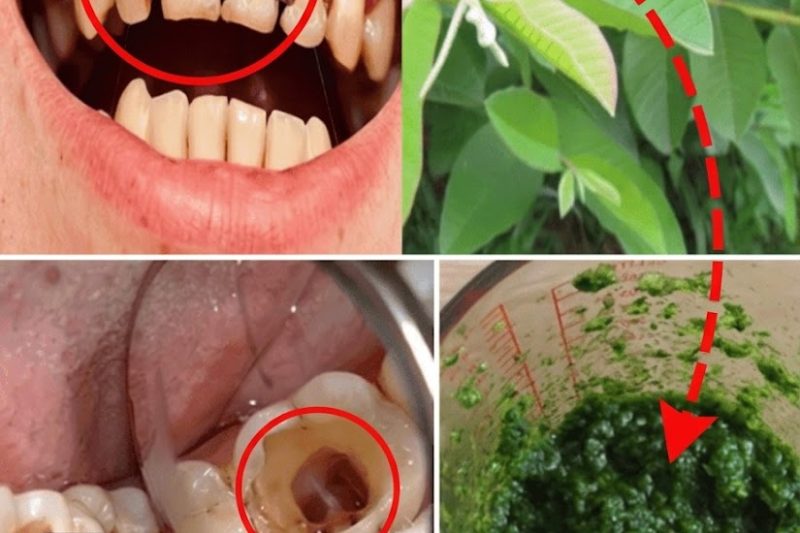 Folhas de Goiaba para um Sorriso Radiante: O Segredo Testado de uma Avó de 70 Anos