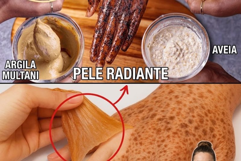 Receita Caseira para Deixar Sua Pele Como Nova: Manchas Escuras Desaparecem Completamente!