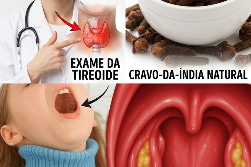 Cravo-da-Índia: o antibiótico natural que ajuda a aliviar dor de garganta e inflamação