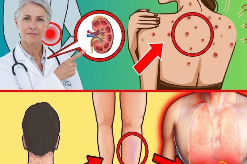 15 Sinais Mortais dos Rins Que Você Precisa Reconhecer Cedo