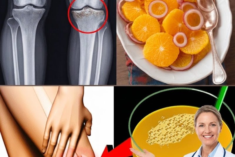 Fortaleça Seus Joelhos Naturalmente: Os Alimentos Secretos Que Protegem Suas Articulações