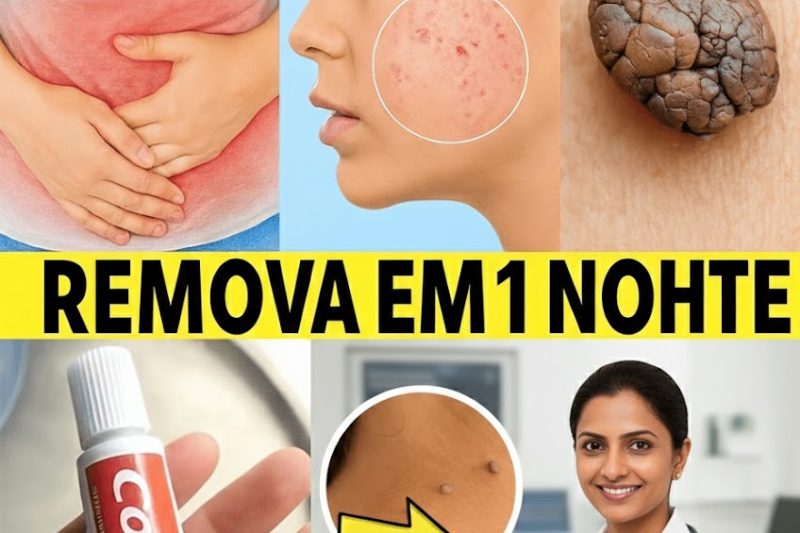 O Segredo Para Uma Pele Impecável Está na Sua Cozinha: O Ritual Noturno Que Combate Crescimentos Indesejados