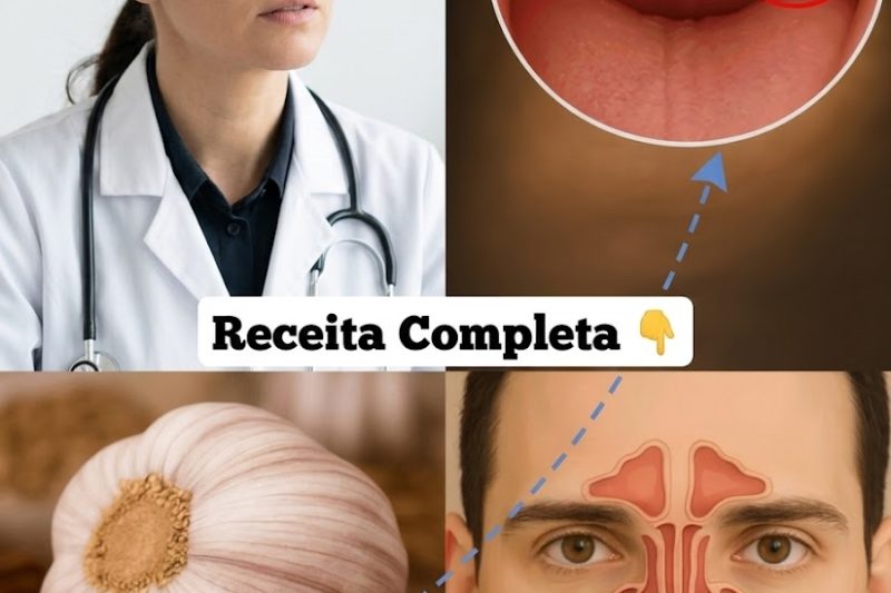 Alho para Infecções do Trato Urinário: Será que Realmente Funciona?