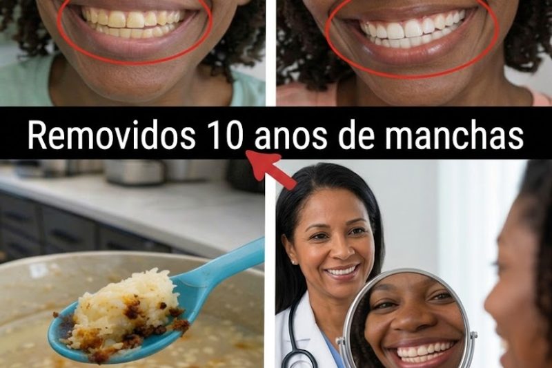 Remova até 10 anos de manchas dos dentes em apenas 2 minutos? A verdade que vai surpreender você