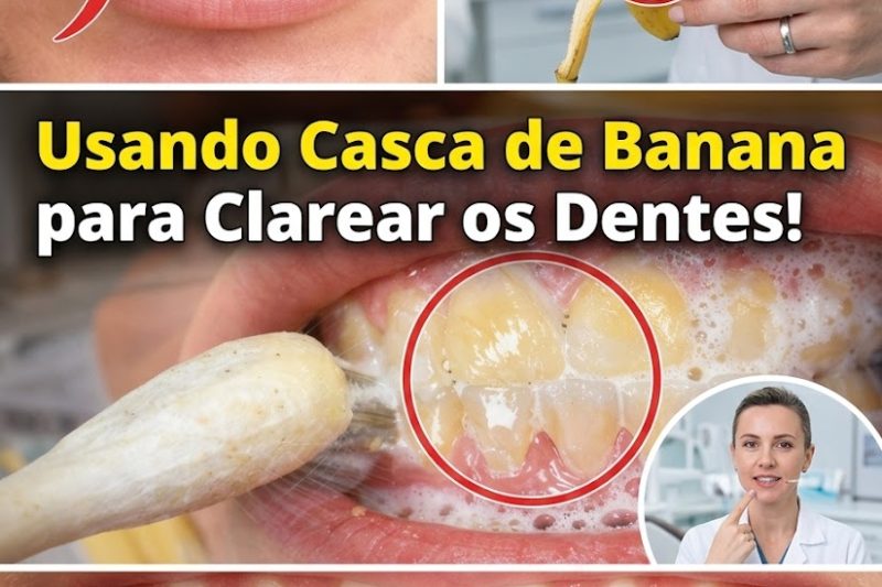 Formas Naturais de Clarear os Dentes Rapidamente – Remédios Caseiros Seguros que Realmente Funcionam