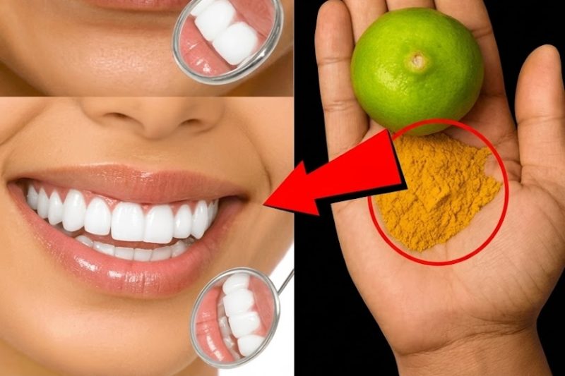 Remédio Natural de Limão e Cúrcuma para Remover Tártaro e Clarear os Dentes