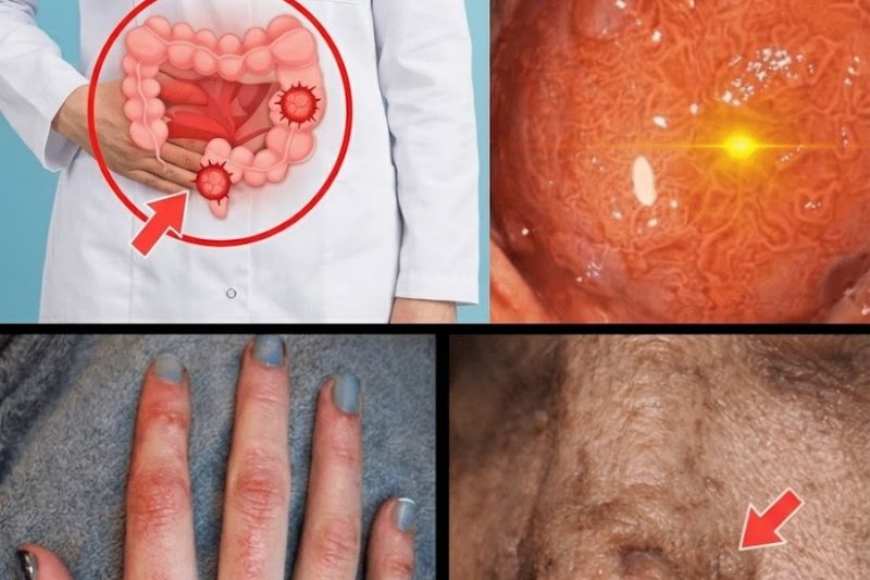 10 Sintomas Silenciosos de Câncer de Cólon que Você Provavelmente Está Ignorando Agora