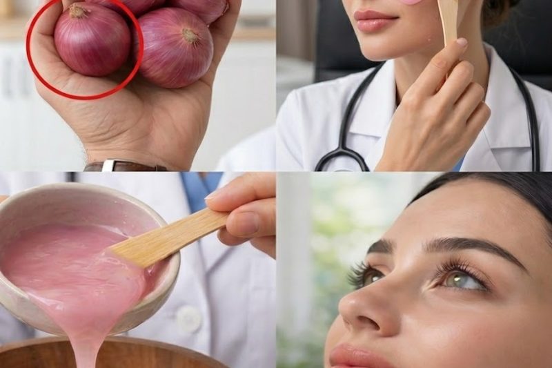 Cebola Roxa no Rosto: O Truque Natural Que Milhares Estão Usando Para Suavizar Rugas, Manchas e Pigmentação