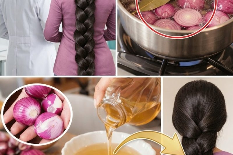 Esfregue Cebola Crua no Couro Cabeludo Todas as Noites – Seu Cabelo Pode Ficar Tão Grosso e Longo que Vão Pensar que é Aplique