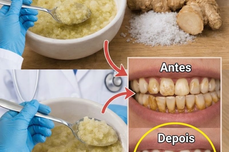 Gengibre e Sal para Clarear os Dentes: Truque Natural Suave ou Apenas Mais uma Moda?