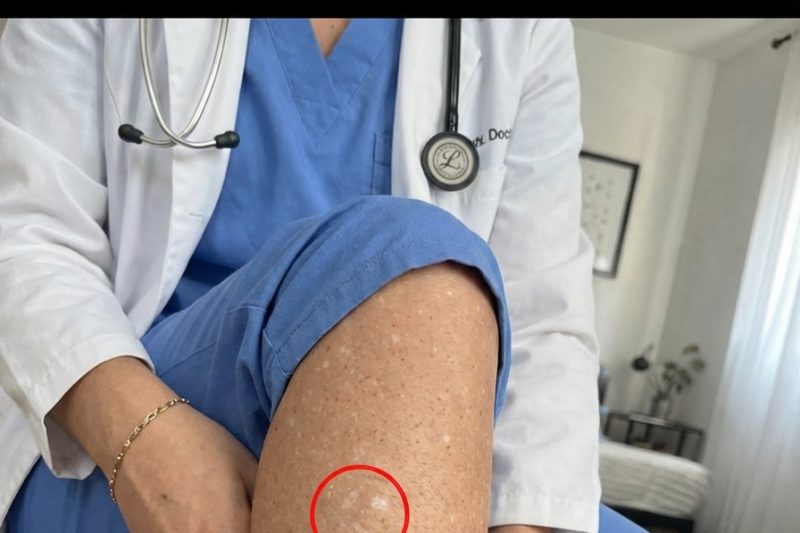 Por que surgem manchas brancas na pele? Causas ocultas que você não deve ignorar