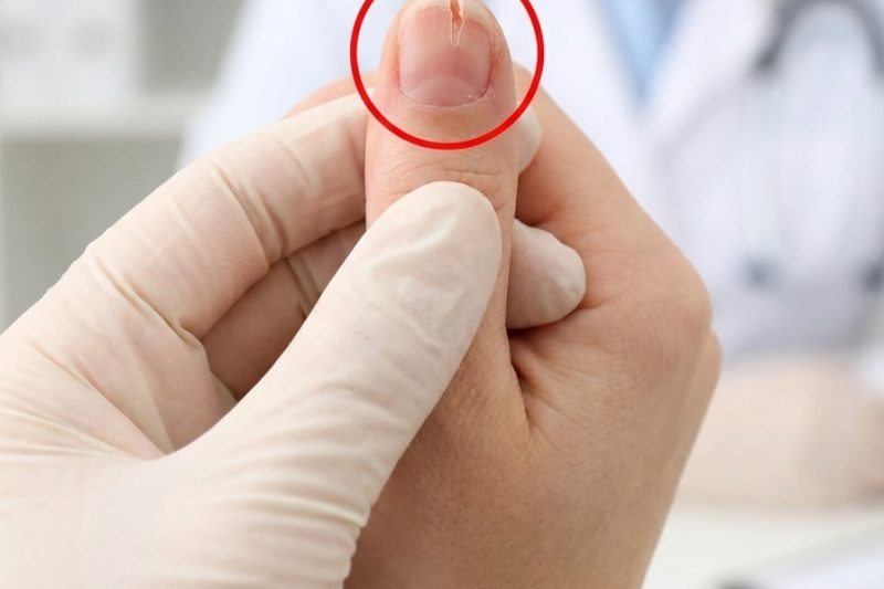 Unhas Quebradiças? 10 Causas Ocultas Que Seu Corpo Está Tentando Revelar — E Como Corrigi-las Rapidamente