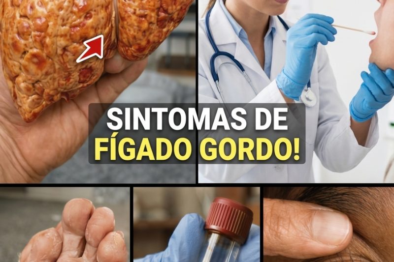 Não Ignore Estes Sintomas: 14 Sinais de Alerta de Fígado Gorduroso (E o Plano Alimentar que Pode Proteger Você)