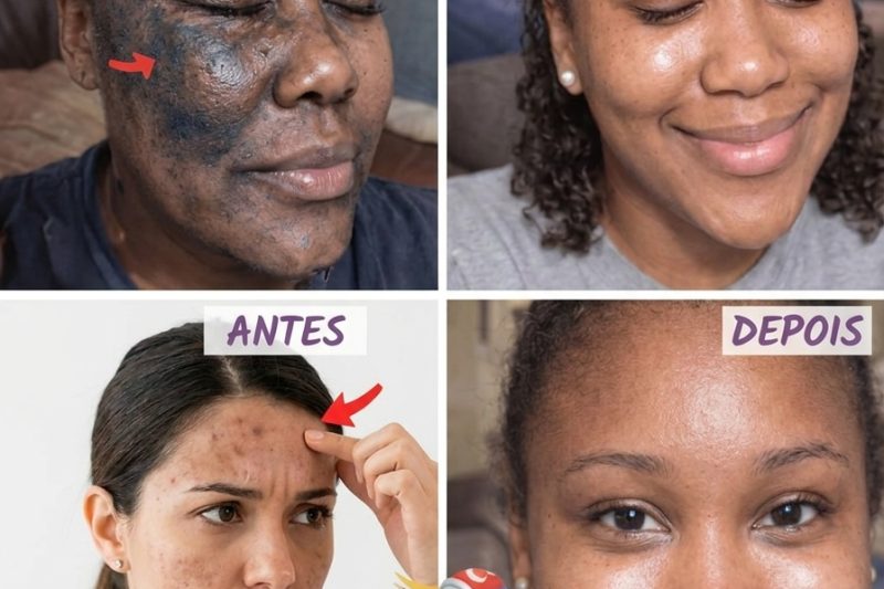 APLIQUEI PASTA DE DENTE COLGATE E VASELINA NO ROSTO — VEJA O QUE ACONTECEU DEPOIS