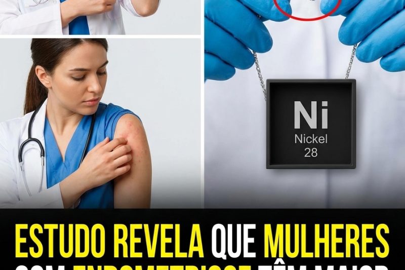 A Sensibilidade ao Níquel Pode Estar Agravando os Sintomas da Endometriose? O Que as Novas Pesquisas Revelam