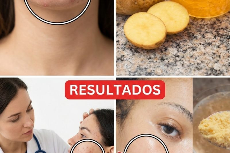 Você Já Experimentou Esta Mistura Simples de Batata e Gengibre para uma Pele Mais Iluminada?