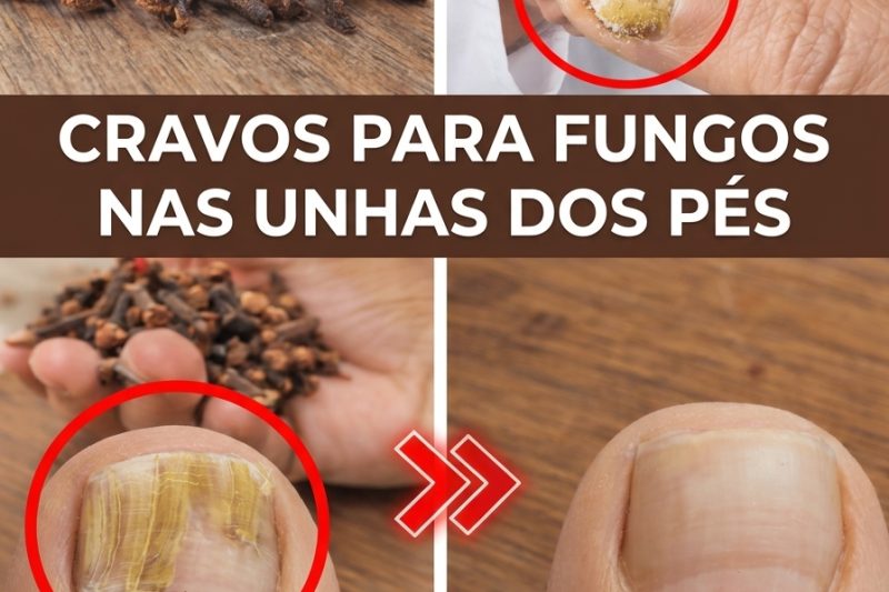 Explorando o Cravo-da-Índia como uma Opção Natural para Melhorar a Aparência de Fungos nas Unhas dos Pés
