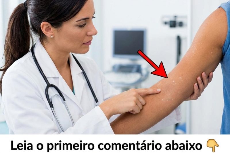 Já Notou Pequenas Manchas Brancas nos Seus Braços ou Pernas? Veja o que Dizem os Especialistas