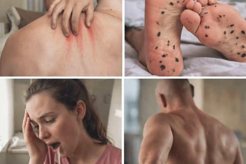 15 Sinais Precoces de Problemas Renais que Você Precisa Conhecer