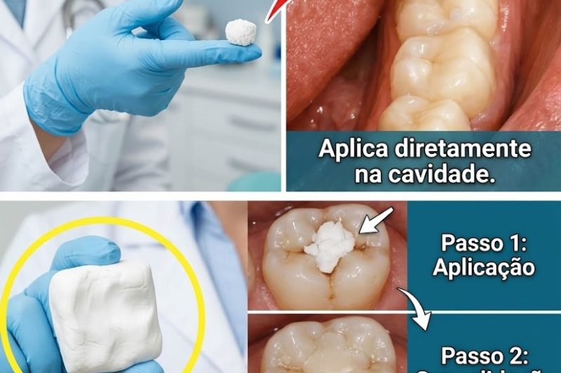 Dicas Naturais Simples para Manter Seus Dentes Saudáveis – Evite Visitas Extras ao Dentista com Estes 5 Remédios Naturais Contra Cáries