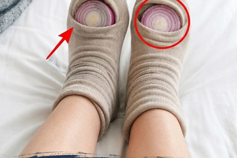 Por que as Pessoas Dormem com Cebolas nas Meias? Explorando este Remédio Caseiro Viral