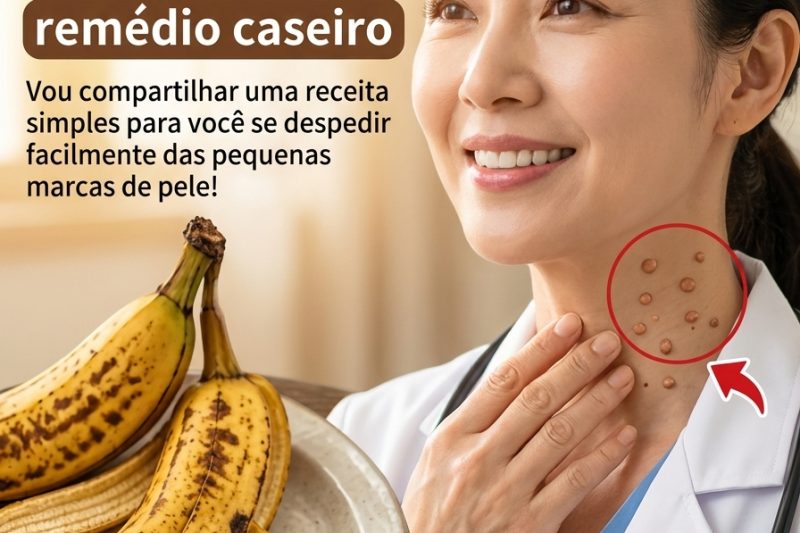 Marcas na Pele: Por que Você Nunca Deve Arrancá-las por Conta Própria?