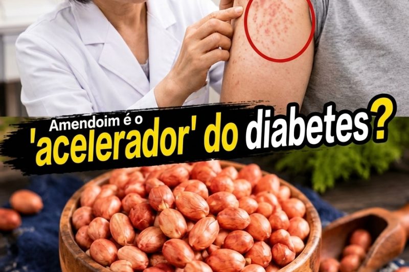 O amendoim causa diabetes? Não cometa mais esse erro