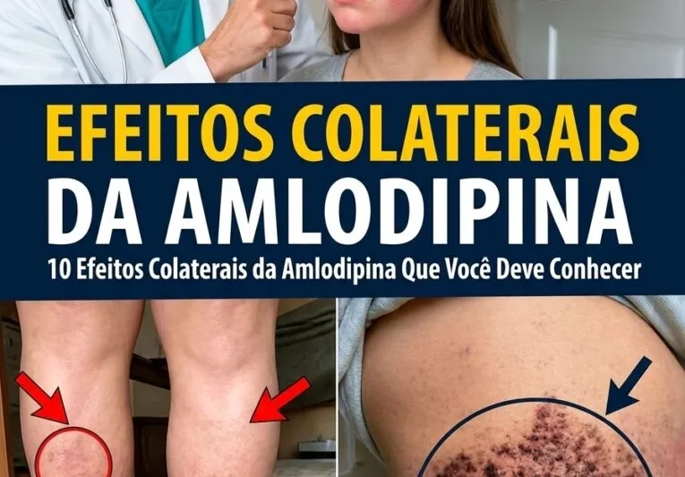 Os 12 Principais Efeitos Colaterais da Anlodipina que Você Deve Conhecer (O que Muitos Pacientes Sentem)