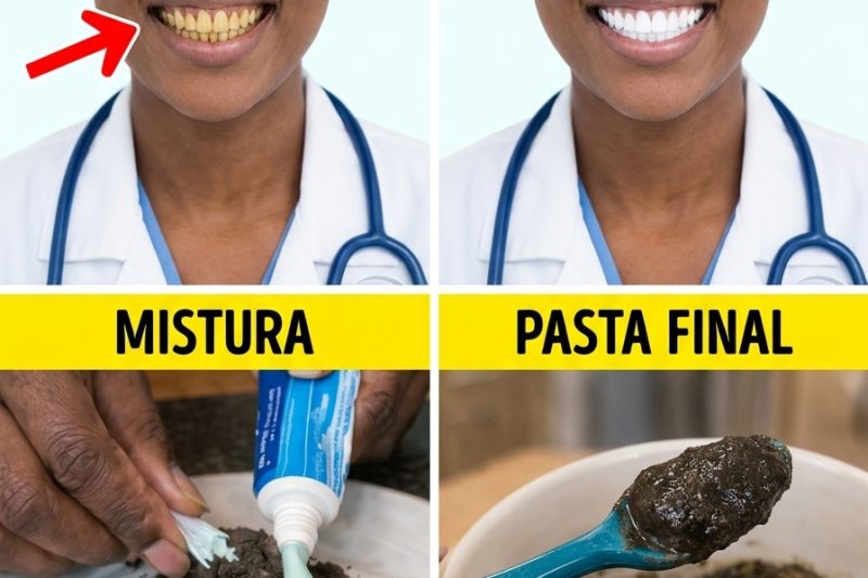 Explorando uma Abordagem Natural Popular para Sorrisos Mais Brancos: A Mistura de Carvão Ativado e Creme Dental
