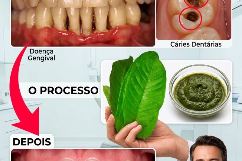 3 Maneiras Naturais de Tratar a Cárie Dentária com Folhas de Goiaba – Simples, Econômico e Muito Eficaz