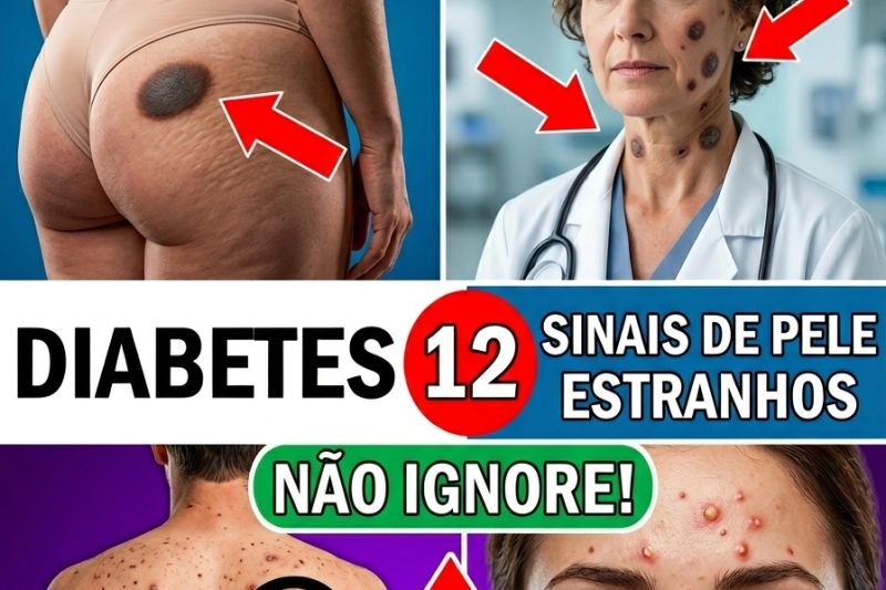 14 Sinais de Alerta de que o Açúcar no Sangue Está Alto (Alerta de Diabetes)