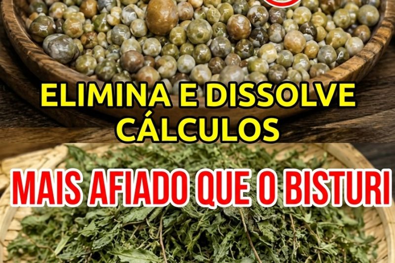 Cálculos Renais: Cuidado com “Remédios Milagrosos” — Você Está Fazendo Certo para Eliminá-los?
