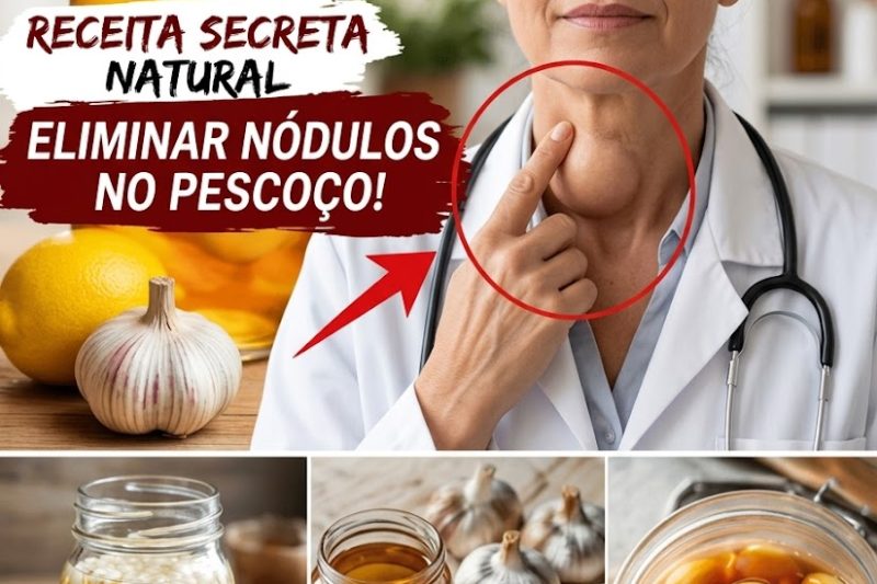 Nódulo na Tireoide: Por Que Você Não Deve Ignorar Esse Sinal?