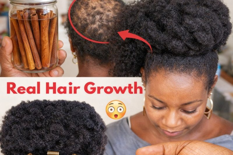 Cravo e Canela: A Dupla Natural de Especiarias que Pode Transformar o Crescimento do Seu Cabelo